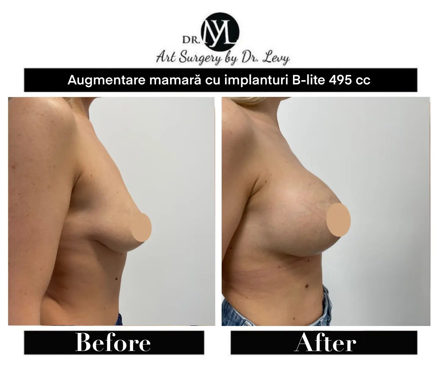 clinica implant mamar