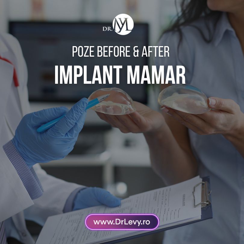 imagini cu implant mamar